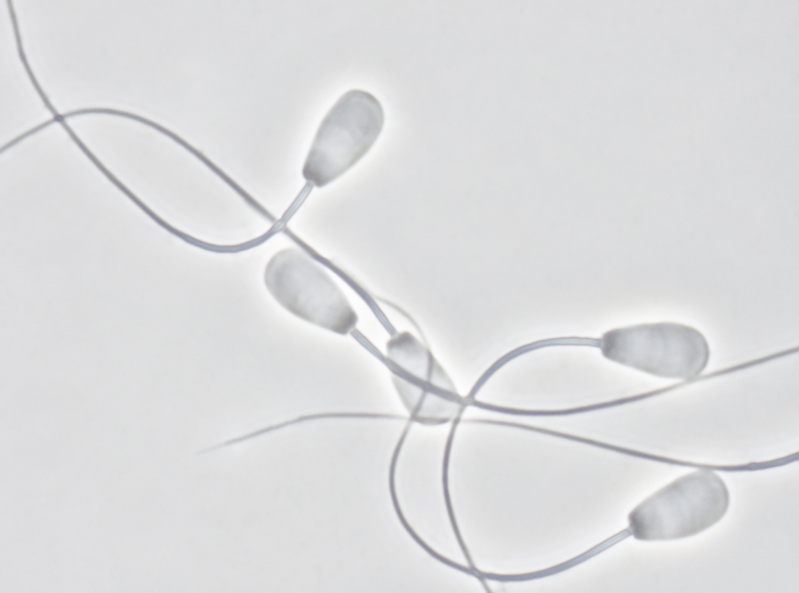 https://olivierlovey.ch/files/gimgs/th-23_63_spermatozoides-de-baron-2.jpg